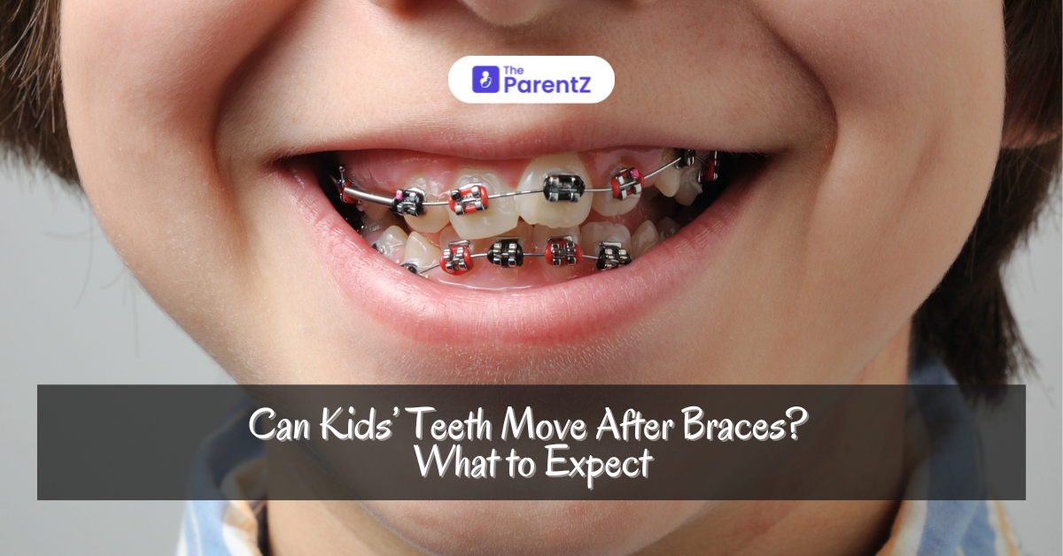 Can Kids' Teeth Move After Braces? What to expect